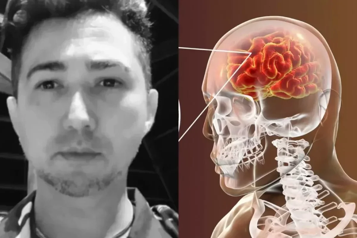 cabeleireiro-morre-de-meningite-no-piaui-veja-causas-sintomas-e-como-se-prevenir-0c7ded69-8903-4f57-9c17-74b0f6b88a4a.jpg