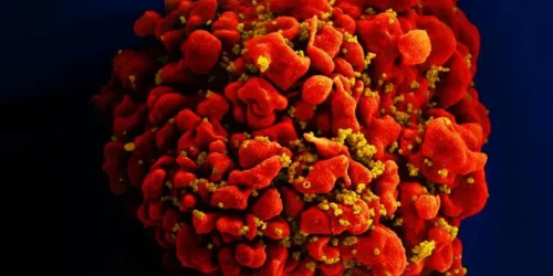 celula-infectada-por-particulas-do-virus-hiv-anexas-a-superficie--951fafa3526c8414