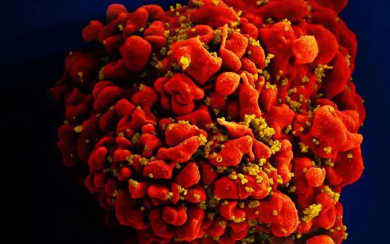 celula-infectada-por-particulas-do-virus-hiv-anexas-a-superficie--951fafa3526c8414