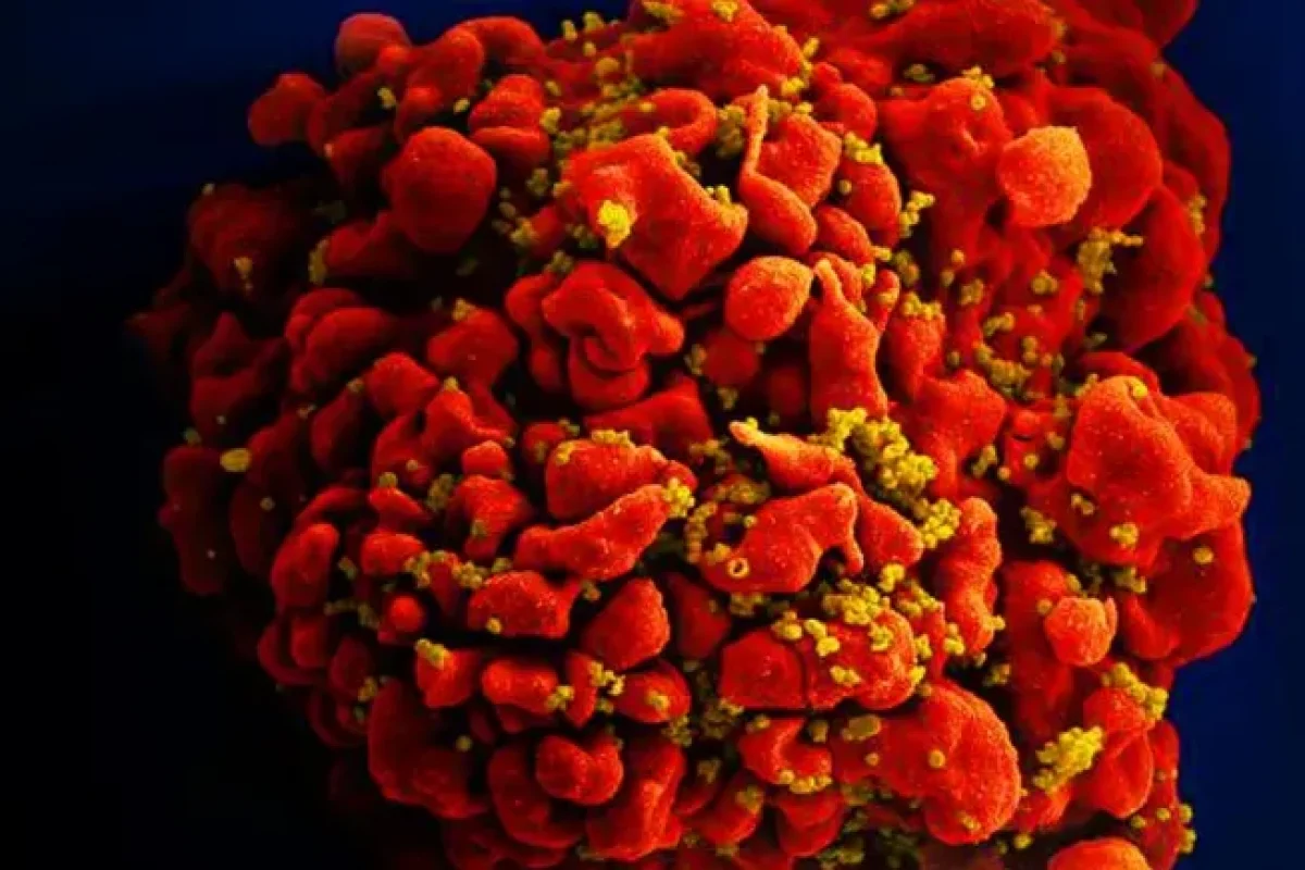 celula-infectada-por-particulas-do-virus-hiv-anexas-a-superficie--951fafa3526c8414