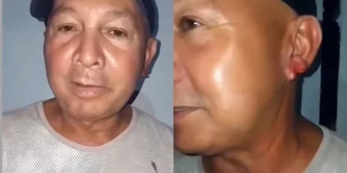 homem-tem-pedaco-de-orelha-arrancada-por-mulher-apos-beijo-em-festa-no-piaui-ae3a75cc-9e37-4227-bba3-4cb4002abf4e.jpg