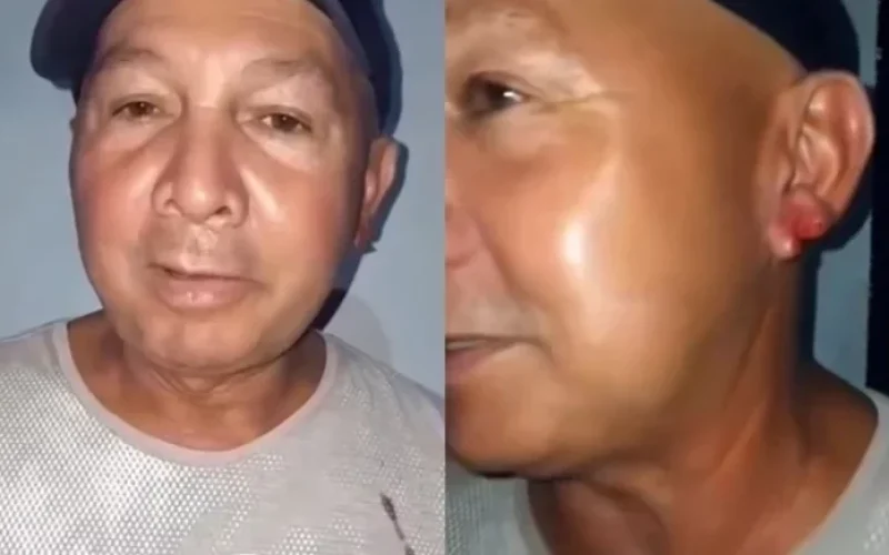 homem-tem-pedaco-de-orelha-arrancada-por-mulher-apos-beijo-em-festa-no-piaui-ae3a75cc-9e37-4227-bba3-4cb4002abf4e.jpg