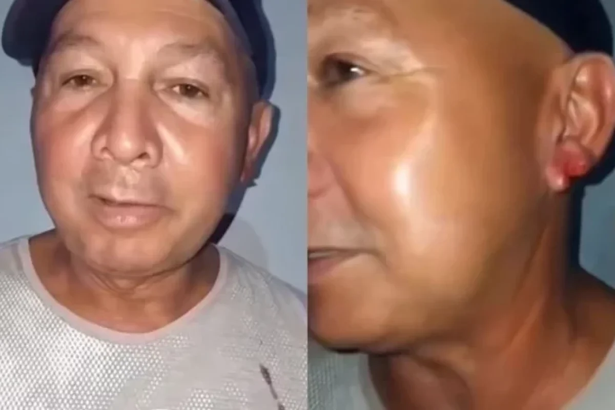 homem-tem-pedaco-de-orelha-arrancada-por-mulher-apos-beijo-em-festa-no-piaui-ae3a75cc-9e37-4227-bba3-4cb4002abf4e.jpg