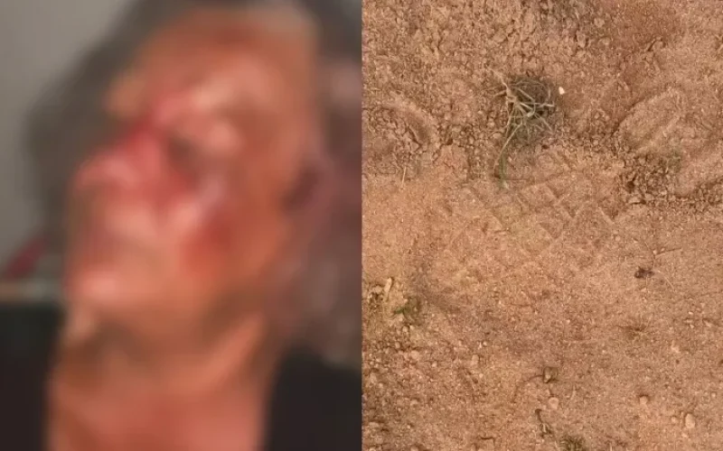 imagens-divulgadas-por-familiares-mostram-pegadas-proximas-ao-local-e-rosto-machucado-da-vitima--0584ccf8cc710bfb