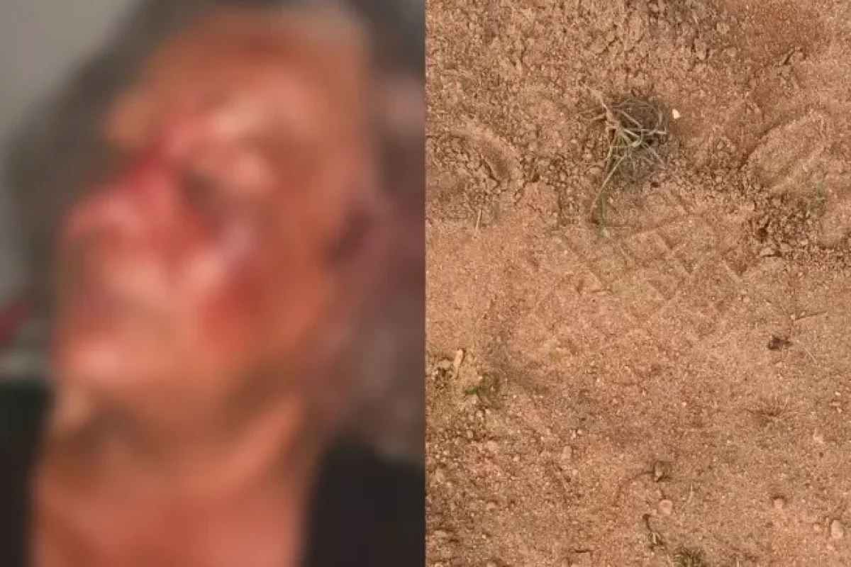 imagens-divulgadas-por-familiares-mostram-pegadas-proximas-ao-local-e-rosto-machucado-da-vitima--0584ccf8cc710bfb