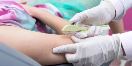 sus-vai-passar-a-oferecer-implante-contraceptivo-a-partir-do-segundo-semestre-3b87321a-ec0b-4348-b9c8-fc2ea414a8a5.jpg