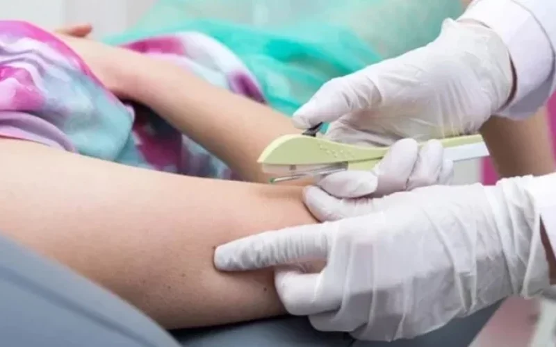 sus-vai-passar-a-oferecer-implante-contraceptivo-a-partir-do-segundo-semestre-3b87321a-ec0b-4348-b9c8-fc2ea414a8a5.jpg