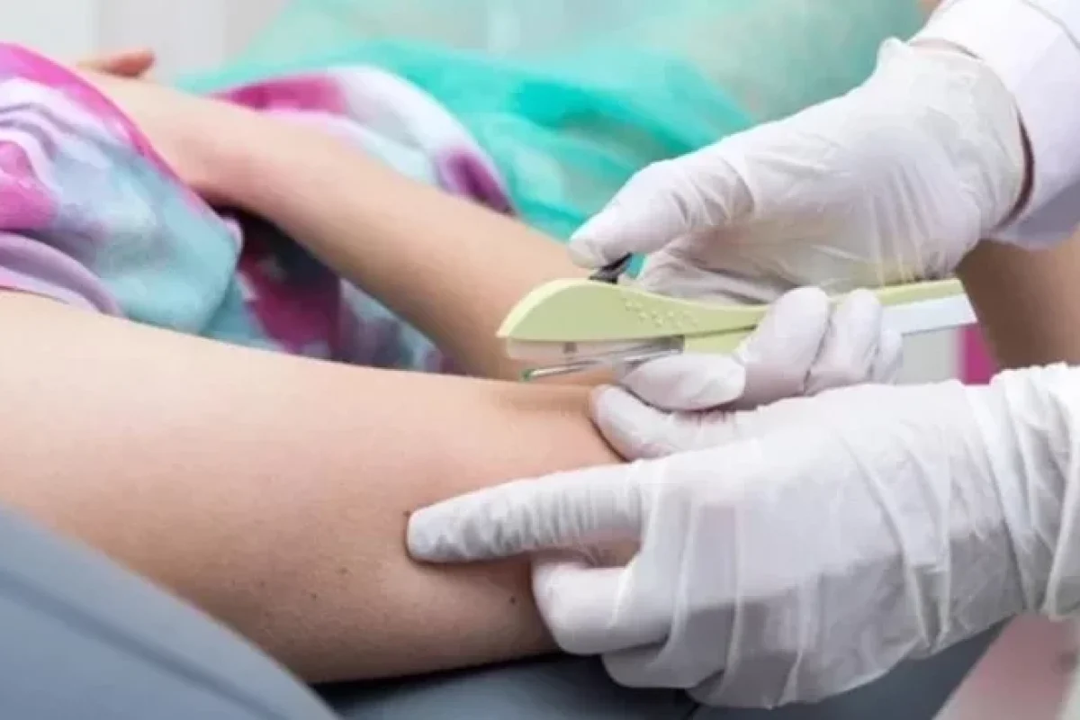 sus-vai-passar-a-oferecer-implante-contraceptivo-a-partir-do-segundo-semestre-3b87321a-ec0b-4348-b9c8-fc2ea414a8a5.jpg